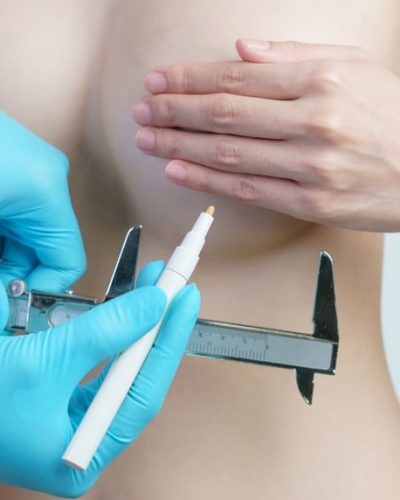 Breast Surgeries