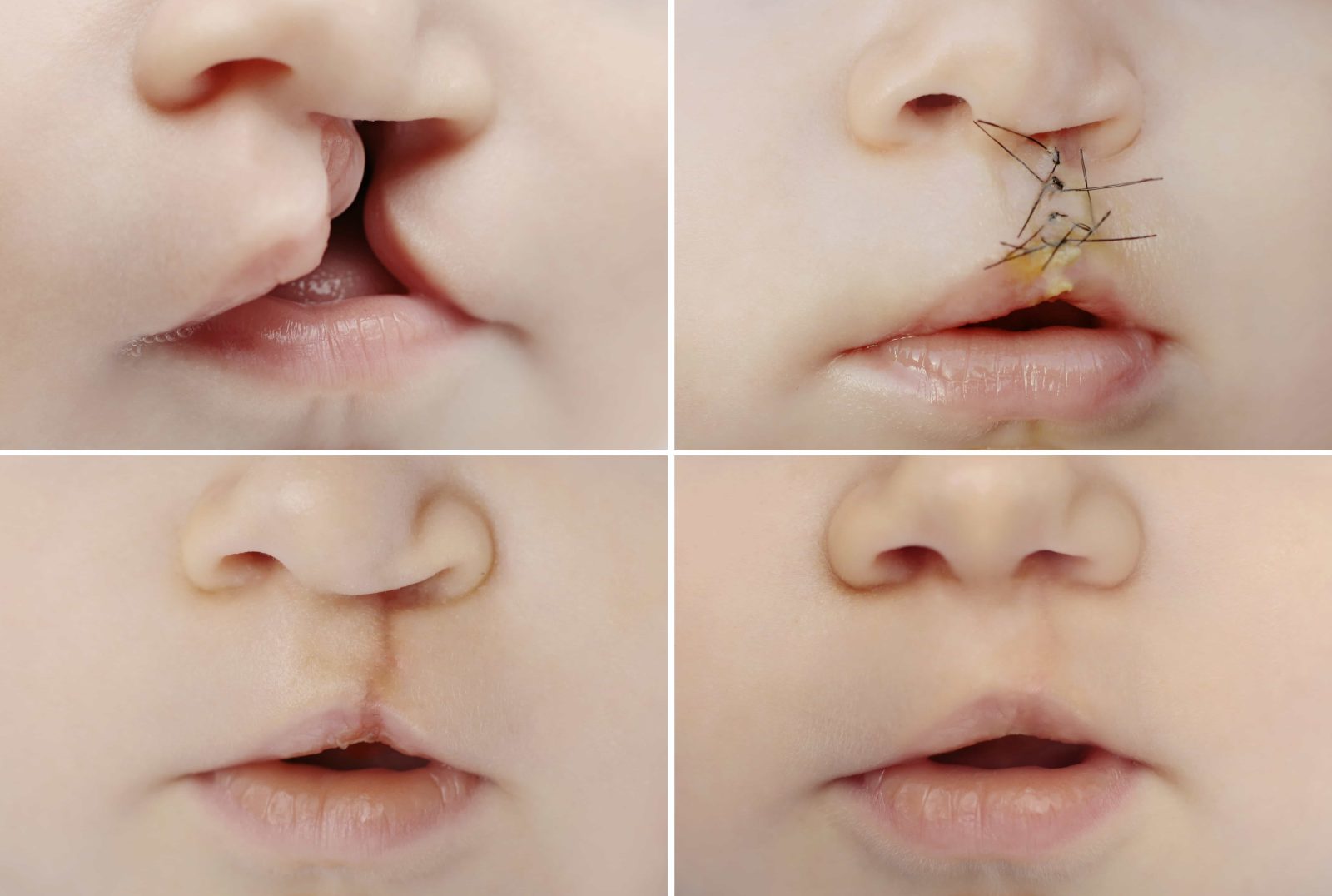 Reconstructive Surgery - Dr. Vivek Gupta's Clinic, Lucknow