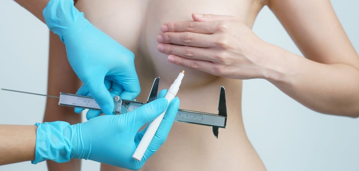 Breast Surgery - Dr. Vivek Gupta's Clinic, Lucknow