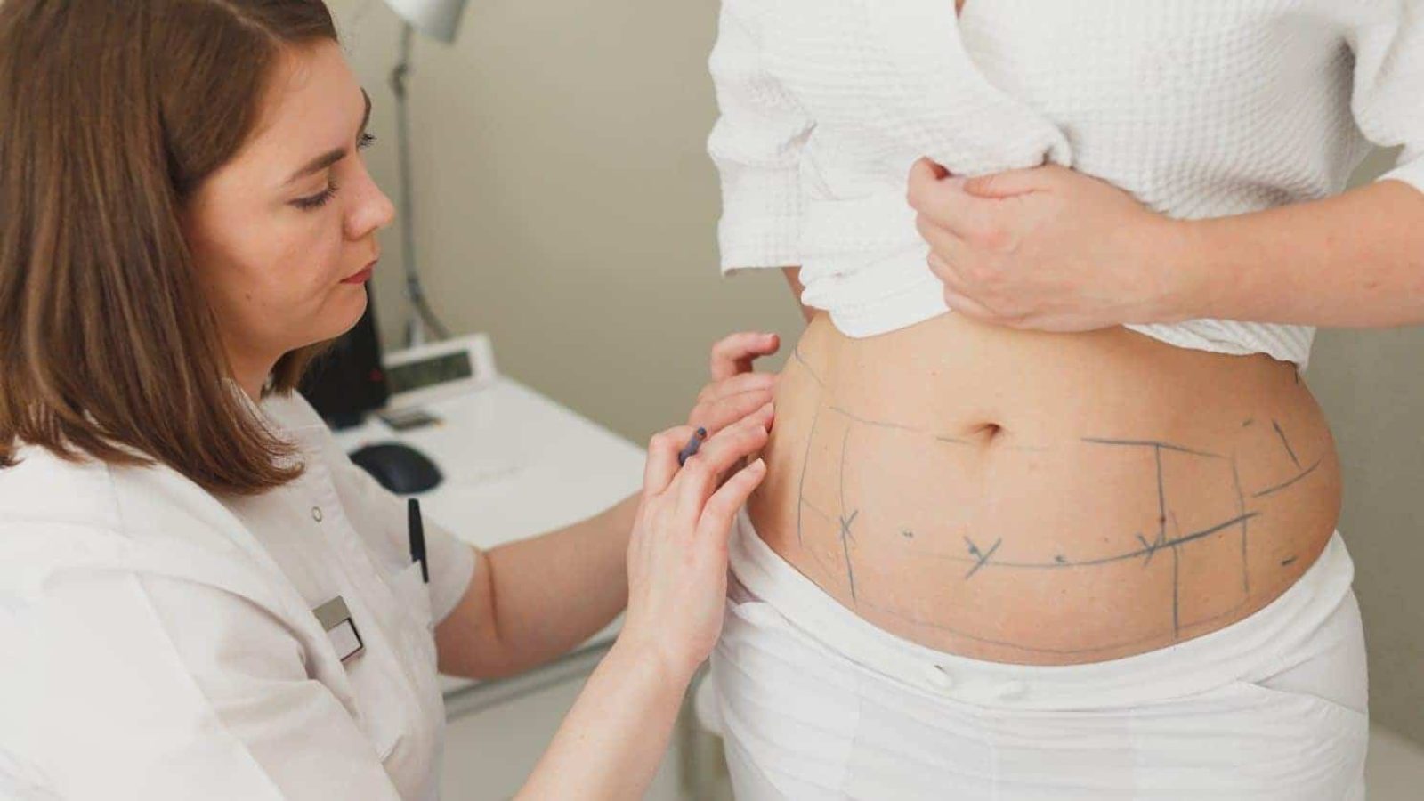 Liposuction - Dr. Vivek Gupta's Clinic, Lucknow